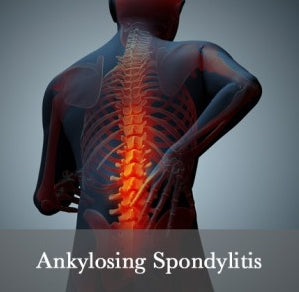 Ankylosing Spondylitis, Symptoms