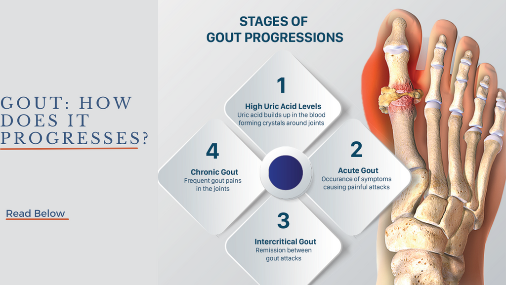 Gout : How does it progress?