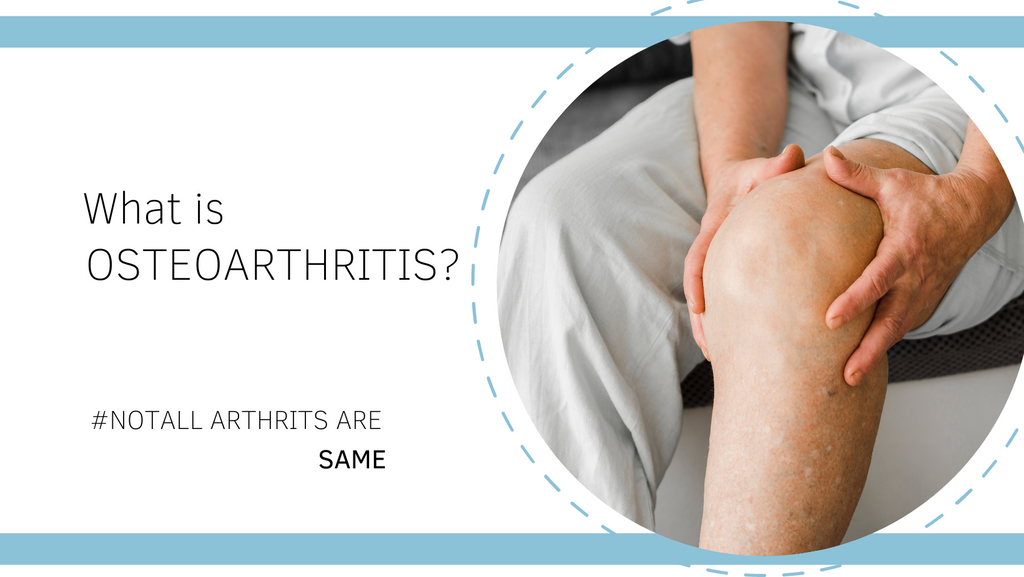 Osteoarthritis: Causes, Symptoms, Risk Factors, and Supplements that Can Help