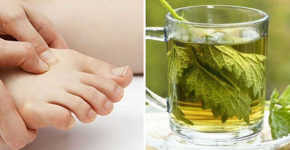 Home Remedies for Treating Gout