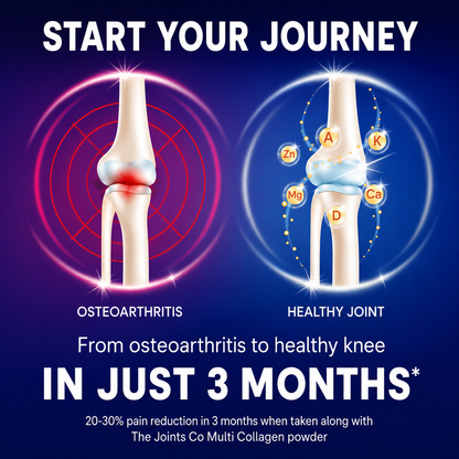 The Joints Co Ultra Ease Plus