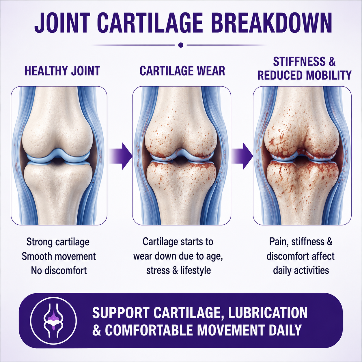 The Joints Co Ultra Ease Plus